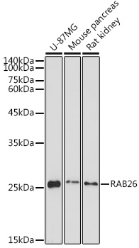 RAB26 Polyclonal Antibody (E-AB-91559)