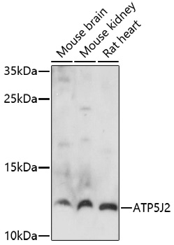 ATP5J2 Polyclonal Antibody (E-AB-91691)