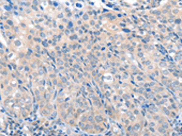 SLC17A6 Polyclonal Antibody (E-AB-53200)