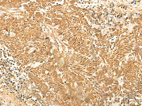 KRT76 Polyclonal Antibody (E-AB-19994)