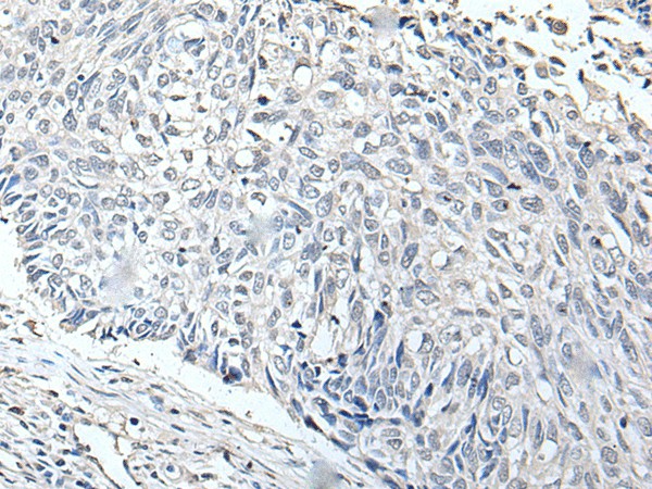 RERG Polyclonal Antibody (E-AB-18283)