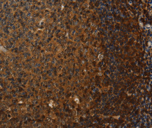 Claudin 8 Polyclonal Antibody (E-AB-15676)