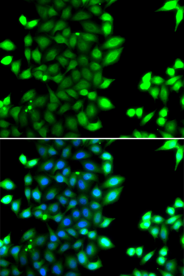 RNF7 Polyclonal Antibody (E-AB-61633)