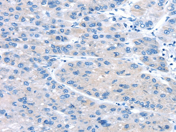 UCP2 Polyclonal Antibody (E-AB-17512)