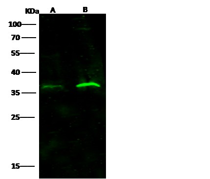 IFNAR2 Monoclonal Antibody (AN200100P)