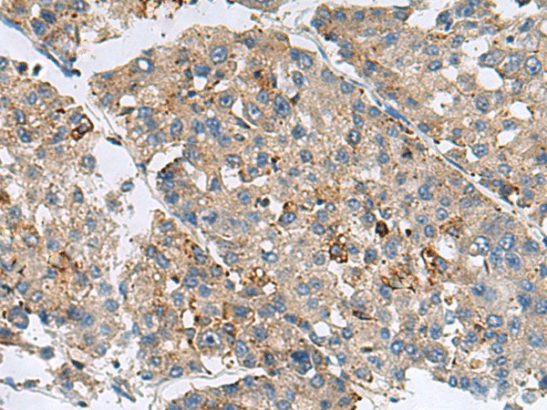 MED31 Polyclonal Antibody (E-AB-19117)