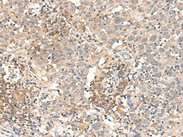 SLC40A1 Polyclonal Antibody (E-AB-17960)