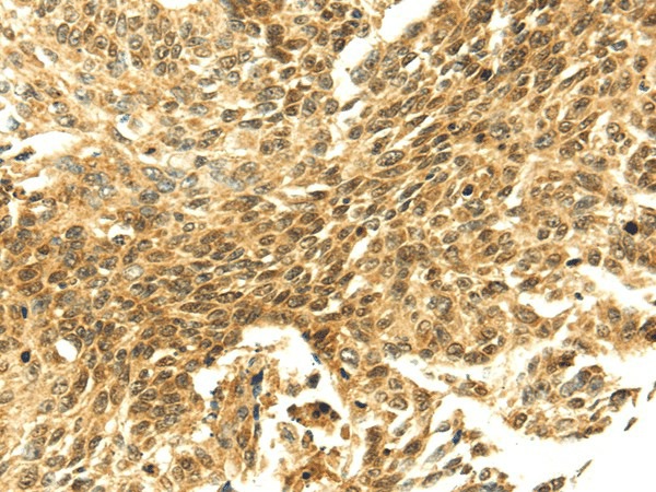 SHPRH Polyclonal Antibody (E-AB-17032)