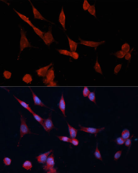 DDAH1 Polyclonal Antibody (E-AB-63338)