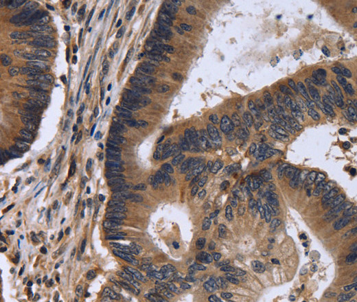 FSTL1 Polyclonal Antibody (E-AB-11247)