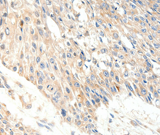SLC27A1 Polyclonal Antibody (E-AB-16064)