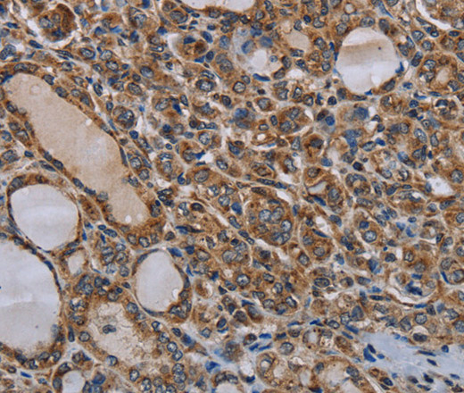 MT-ND6 Polyclonal Antibody (E-AB-16622)