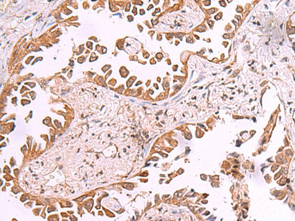 AK9 Polyclonal Antibody (E-AB-52944)