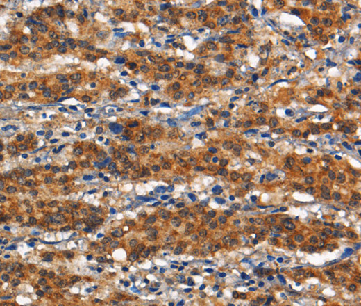 CD13 Polyclonal Antibody (E-AB-12771)