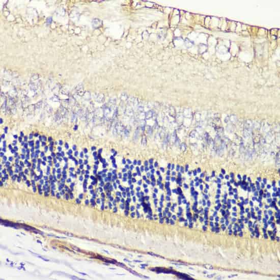 GRK1 Polyclonal Antibody (E-AB-60810)