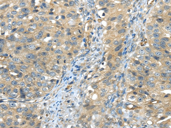 ISM2 Polyclonal Antibody (E-AB-17451)