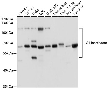 C1 Inactivator Polyclonal Antibody (E-AB-60419)