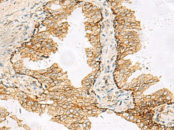 SH3YL1 Polyclonal Antibody (E-AB-53020)