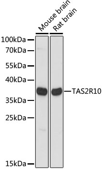 TAS2R10 Polyclonal Antibody (E-AB-65221)