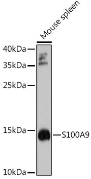 S100A9 Polyclonal Antibody (E-AB-62904)