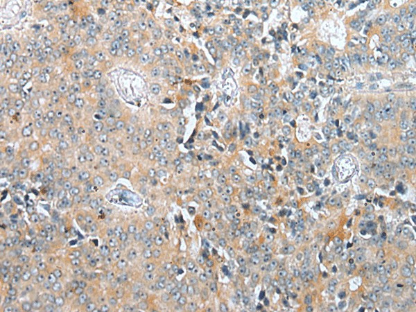 COMMD6 Polyclonal Antibody (E-AB-18376)