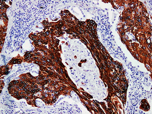 CK17 Monoclonal Antibody (ELAB6624-M)