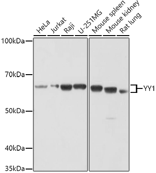 YY1 Polyclonal Antibody (E-AB-90534)