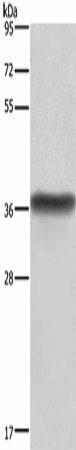 HSD17B1 Polyclonal Antibody (E-AB-16497)