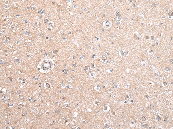 GJB5 Polyclonal Antibody (E-AB-17710)