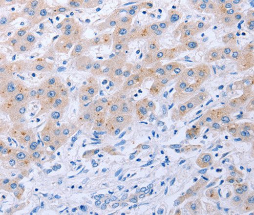 FGF4 Polyclonal Antibody (E-AB-12294)