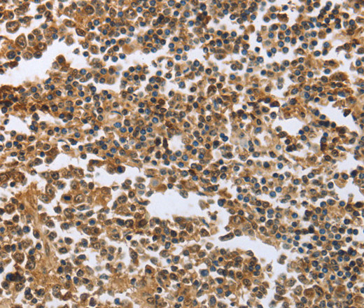 ECE1 Polyclonal Antibody (E-AB-14052)