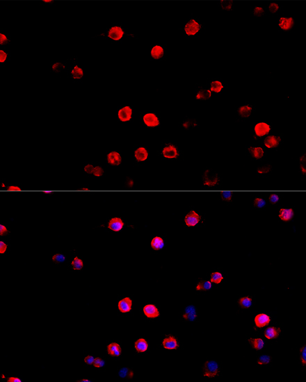 PD-L1 Polyclonal Antibody (E-AB-60391)