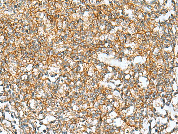 RAB13 Polyclonal Antibody (E-AB-53081)