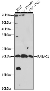 RABAC1 Polyclonal Antibody (E-AB-92172)