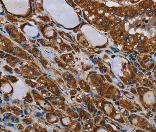 MT-ND1 Polyclonal Antibody (E-AB-16621)