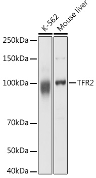 TFR2 Polyclonal Antibody (E-AB-92998)