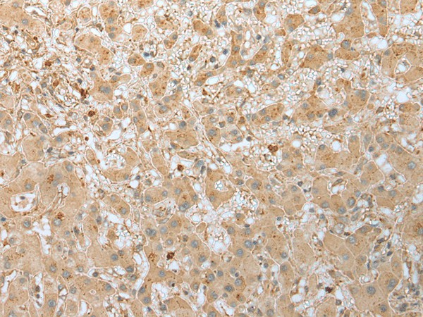 FNDC3B Polyclonal Antibody (E-AB-52260)