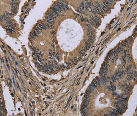 MYO18B Polyclonal Antibody (E-AB-16627)