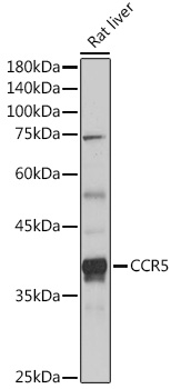 CCR5 Polyclonal Antibody (E-AB-92210)