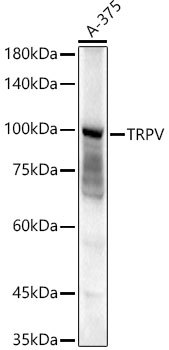 TRPV4 Polyclonal Antibody (E-AB-92663)