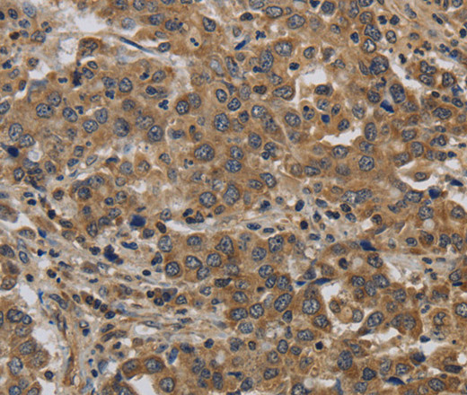 KIF4A Polyclonal Antibody (E-AB-13364)