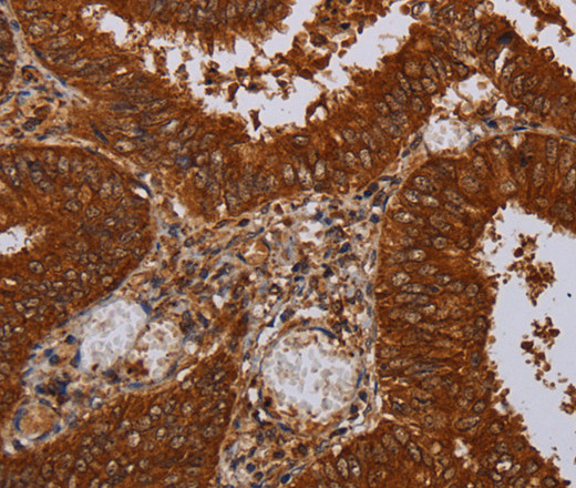 MFAP3L Polyclonal Antibody (E-AB-11391)