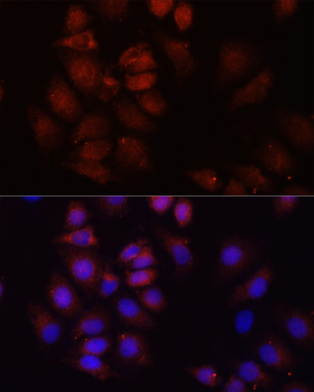 HRNR Polyclonal Antibody (E-AB-66877)