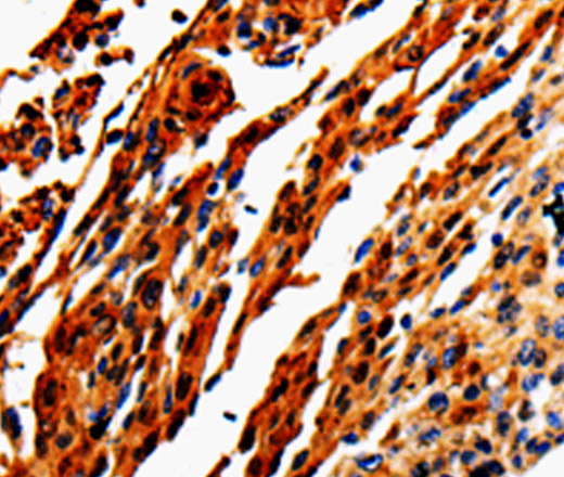 ADD1 Polyclonal Antibody (E-AB-13796)