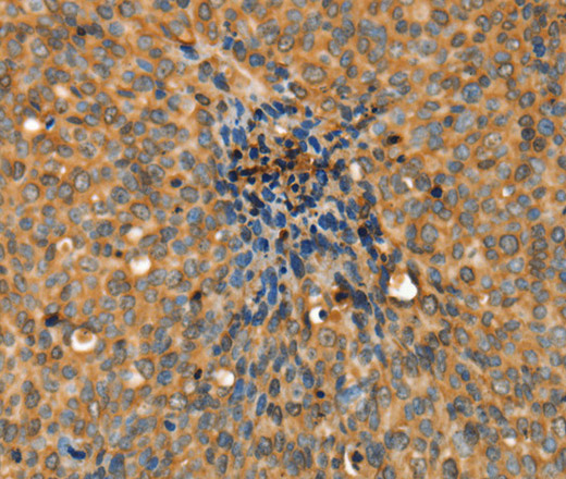 ADCY3 Polyclonal Antibody (E-AB-14760)