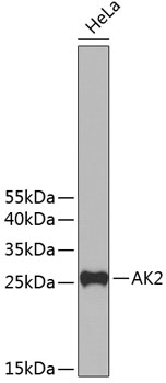 AK2 Polyclonal Antibody (E-AB-92548)