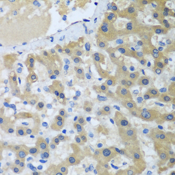 XPC Polyclonal Antibody (E-AB-62267)