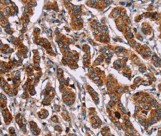 ID2 Polyclonal Antibody (E-AB-16502)