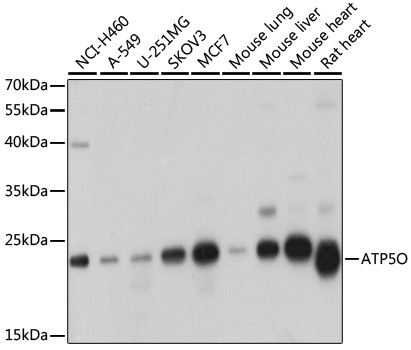 ATP5O Polyclonal Antibody (E-AB-62010)