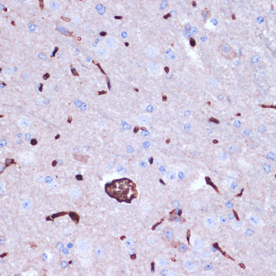 PROK2 Polyclonal Antibody (E-AB-62508)